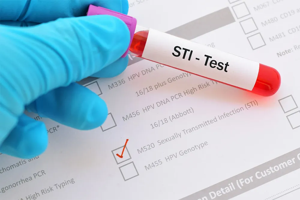 Кога е разумно да си направите STI тест: 7 ситуации, в които е добре да имате яснота